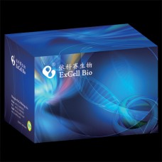 ExGen #CS012-0009 10-300ul clear tips, DNase/RNase free, 1000/bag